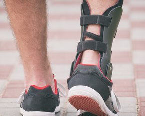 Ein Fuß mit einer Schiene, der in einem sportlichen Schuh steht, während er auf einem gepflasterten Weg geht.